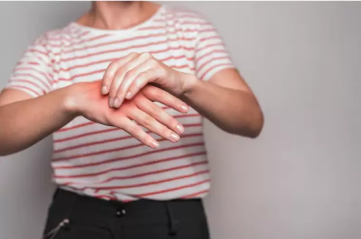 Carpal Tunnel Syndrome
