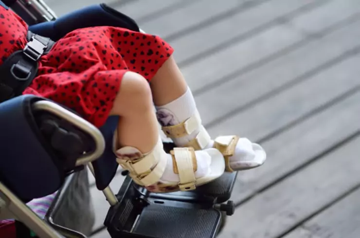 cerebral-palsy
