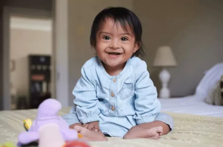 Down Syndrome